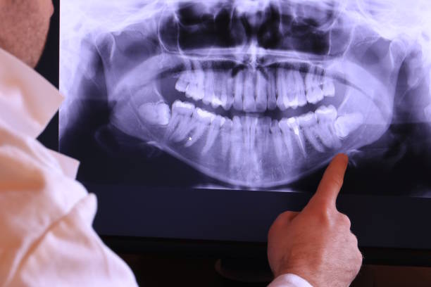 Best Walk-In Emergency Dentist in Muskegon, MI